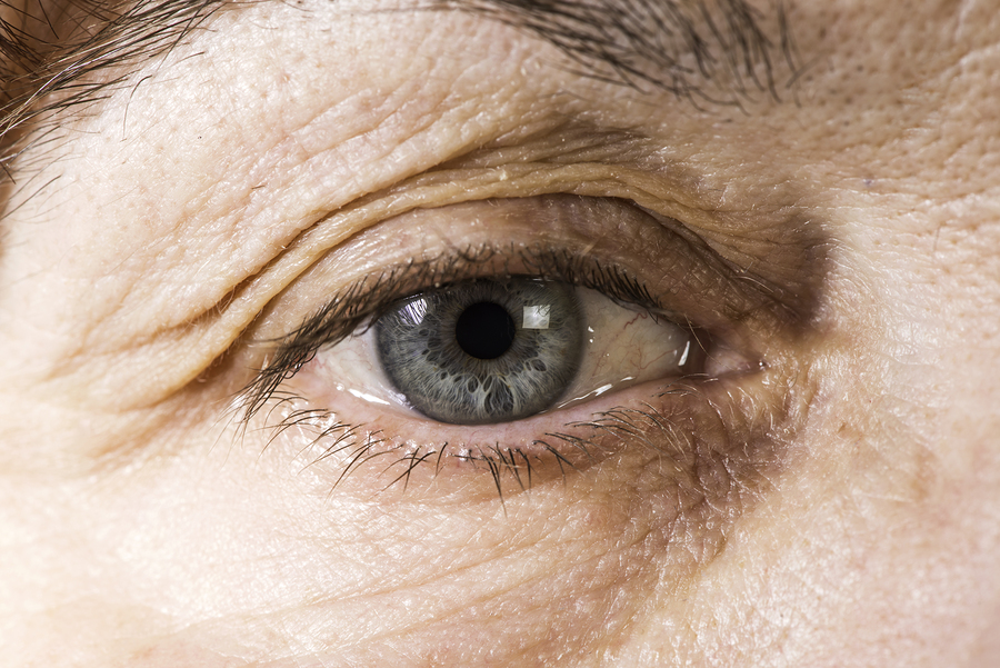 Blepharoplastyka